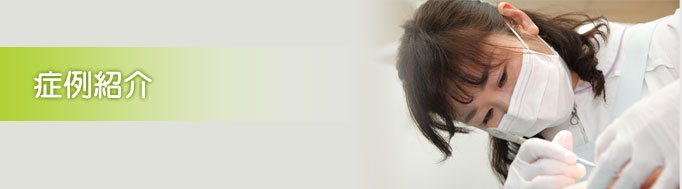 症例紹介