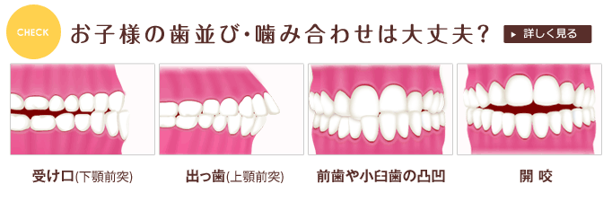 お子様の歯並び・噛み合わせは大丈夫？